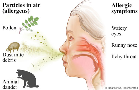 air allergy