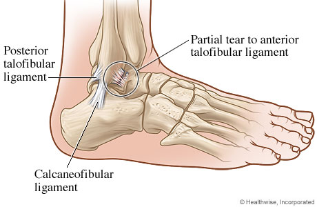 Foot 2024 ligament pain