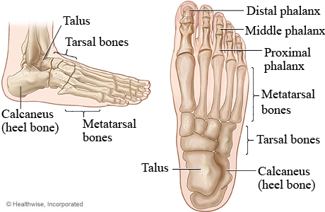 bone spur middle of foot