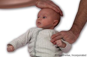 Torticollis stretch