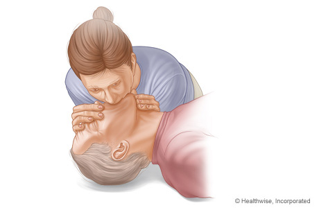 CPR on adult, showing correct position for rescue breaths.